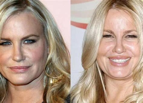 jennifer coolidge before plastic surgery|Jennifer Coolidge Plastic Surgery: Shocking Before and After Look!